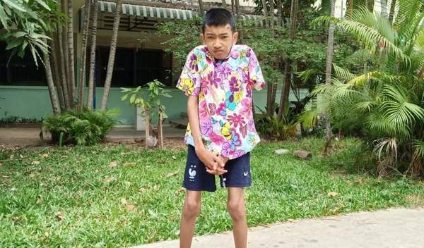 Photo of Rathana post-operation