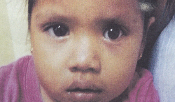 Photo of Alma post-operation