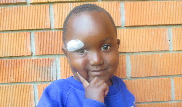 Photo of Kyobutungi post-operation