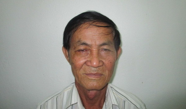 Photo of Teang post-operation