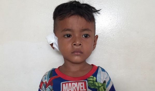 Photo of Rithy post-operation