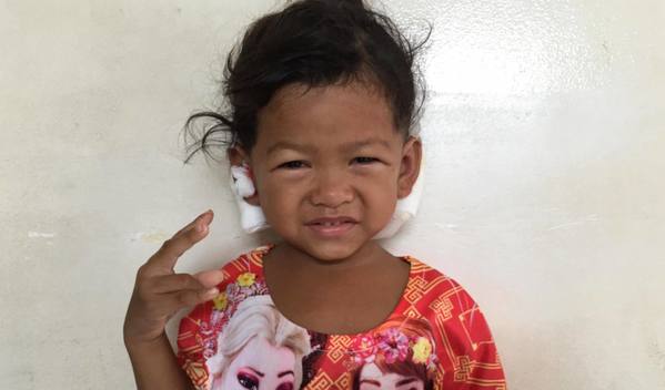 Photo of Neang post-operation