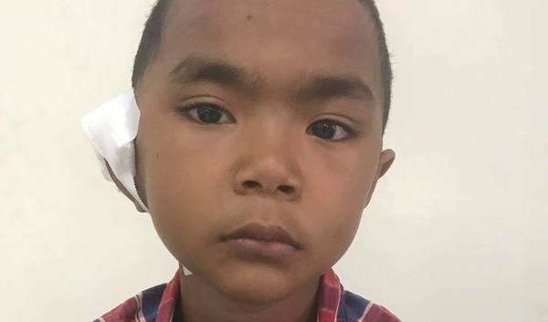 Photo of Phearith post-operation