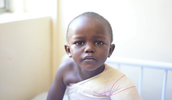 Photo of Immanuel post-operation