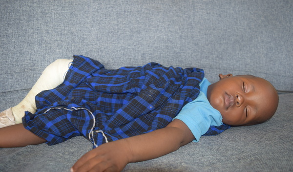 Photo of Periya post-operation