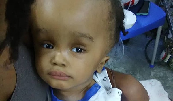 Photo of Joven post-operation