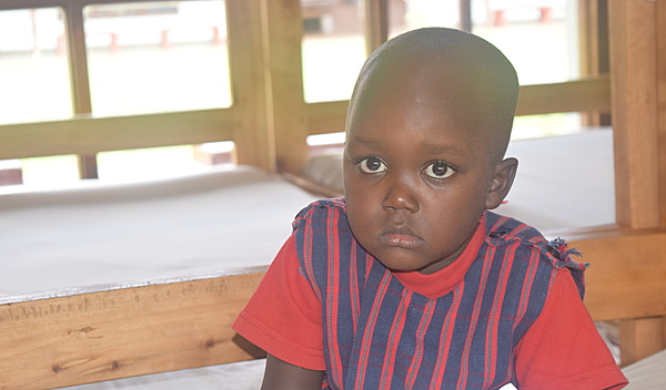 Success! Mapai from Tanzania raised $880 to fund corrective surgery to ...