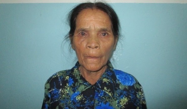 Photo of Bang Lat post-operation
