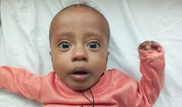 Photo of Abi post-operation