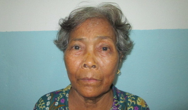 Photo of Phorn post-operation