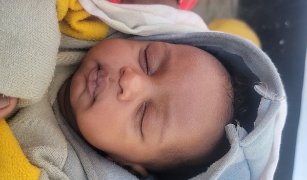 Photo of Neema post-operation
