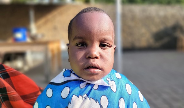 Photo of Pendo post-operation