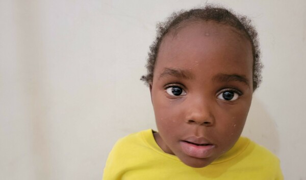 Photo of Catherine post-operation