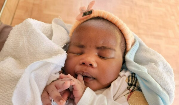 Photo of Godlove post-operation