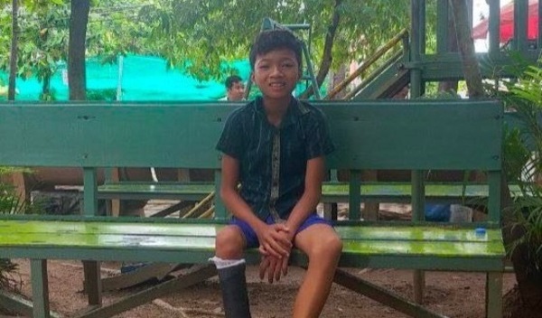 Photo of Veasna post-operation