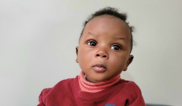 Photo of Joseph post-operation