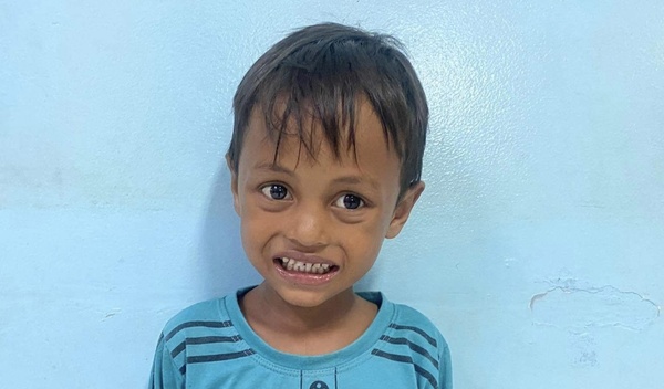 Photo of Soktheang post-operation