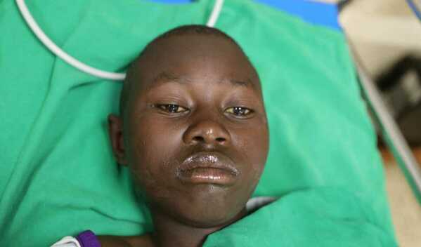 Photo of Samuel post-operation