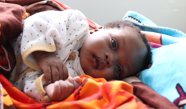 Photo of Nyakek post-operation