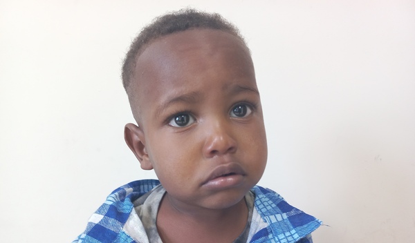 Photo of Solomon post-operation