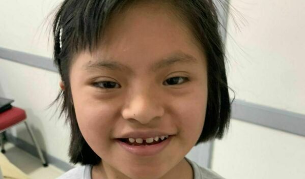 Photo of Jasmin post-operation