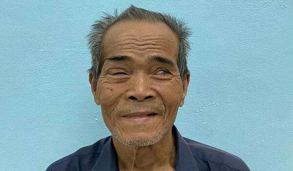 Photo of Yean post-operation