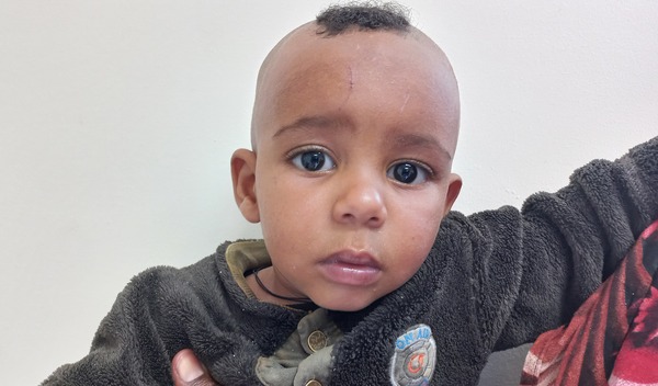 Photo of Kenay post-operation