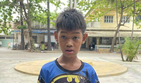 Photo of Chhy post-operation