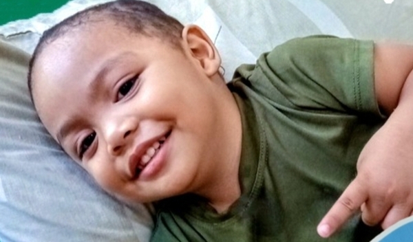 Photo of Michael Angelo post-operation