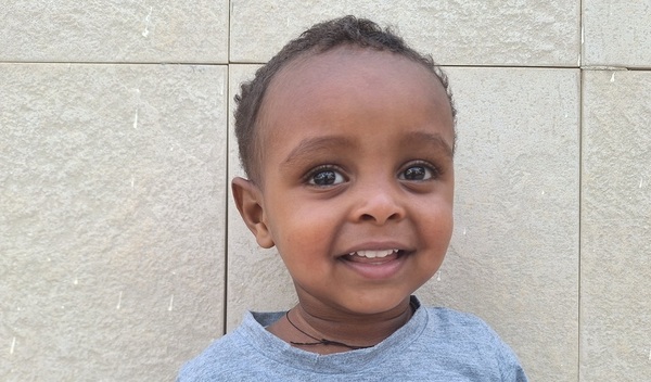 Photo of Biyana post-operation