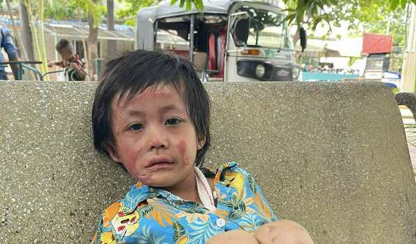Photo of Chheng Huong post-operation