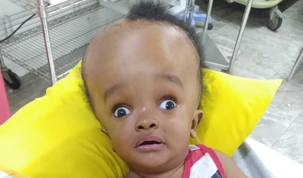 Photo of Arthur post-operation