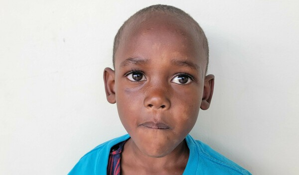 Photo of Lightness post-operation