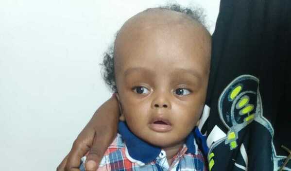 Photo of Jayden post-operation