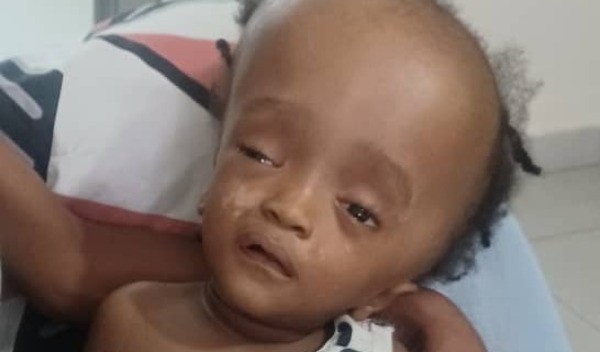 Photo of Christopher post-operation
