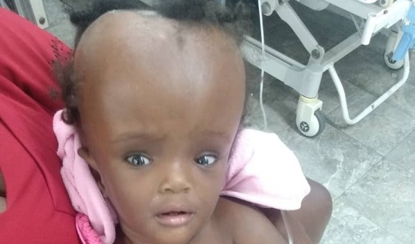 Photo of Dieuralna post-operation