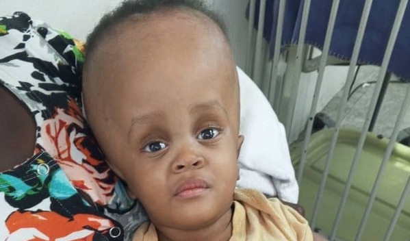 Photo of Vincent post-operation