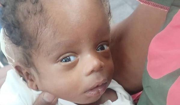 Photo of Jayden post-operation