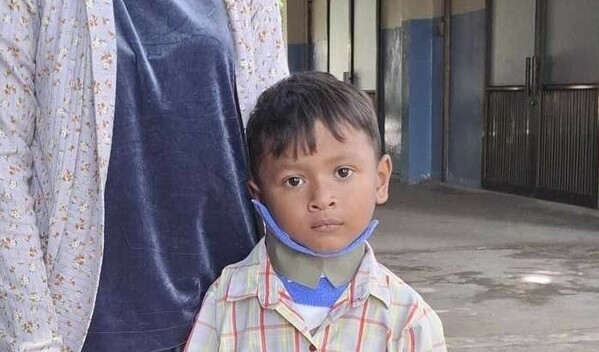 Photo of Yarith post-operation