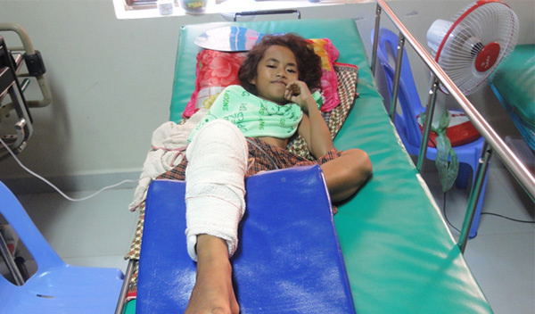 Photo of Chakriya post-operation