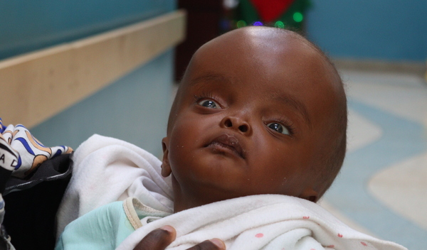 Photo of Bahati post-operation