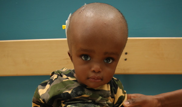 Photo of Flavian post-operation