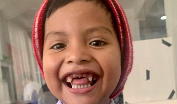 Photo of Eithan post-operation