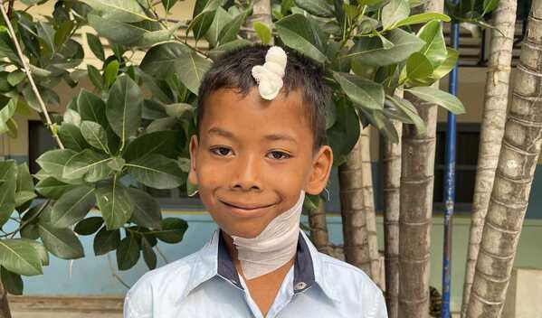 Photo of SokMean post-operation