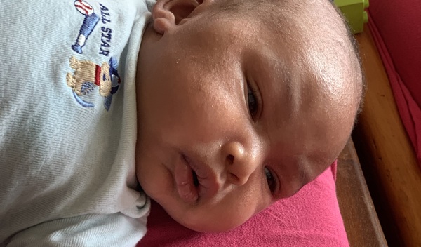 Photo of Pius post-operation
