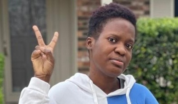 Photo of Dgylanie post-operation