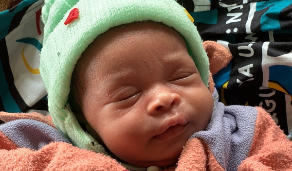 Photo of Michael post-operation
