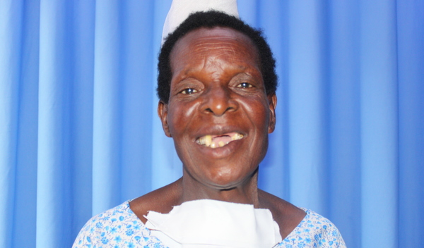 Photo of Edinesi post-operation