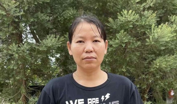 Photo of Naw post-operation