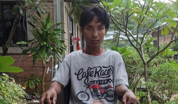 Photo of Nay post-operation